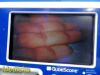 VERATHON Glidescope Portable GVL,W/ 0574-0001 Baton, Cradle, Stand~, Monitor
