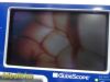 VERATHON Glidescope Portable GVL,W/ 0574-0001 Baton, Cradle, Stand~, Monitor