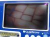 VERATHON Glidescope Portable GVL,W/ 0574-0001 Baton, Cradle, Stand~, Monitor