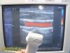 SIEMENS 2008  VFX9-4 Ref 05936237 Linear Array Ultrasound Probe /