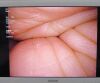 OLYMPUS WA50052A Laparoscope