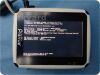 SITE RITE PREVUE Ultrasound  System