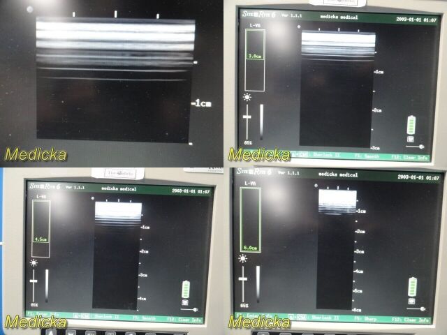 BARD Chison Med SiteRite VI 9770066 Sherlock II  Vascular Access Sys W/ Probe