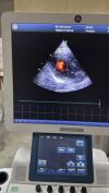 GE Vivid T8 Ultrasound - Cardiac - Vascular