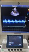 GE Vivid T8 Ultrasound - Cardiac - Vascular