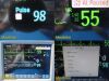 PHILIPS 2014  Intellivue MP30 Patient Monitor