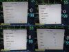 PHILIPS 2014  Intellivue MP30 Patient Monitor