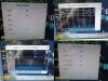 PHILIPS 2014  Intellivue MP30 Patient Monitor