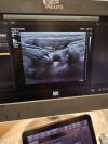 PHILIPS Affiniti 70G Rev:B 2018 C5-1,L12-3 Ultrasound - Cardiac - Vascular
