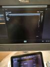 PHILIPS Affiniti 70G Rev:B 2018 C5-1,L12-3 Ultrasound - Cardiac - Vascular