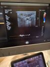 PHILIPS Affiniti 70G Rev:B 2018 C5-1,L12-3 Ultrasound - Cardiac - Vascular