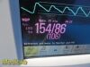 PHILIPS 2009  Intellivue MP30 Masimo SpO2 Monitor