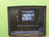 GE LOGIQ E NEXTGEN Ultrasound Machine w/ L8-18i-RS & L4-12T-RS Probes