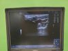 GE LOGIQ E NEXTGEN Ultrasound Machine w/ L8-18i-RS & L4-12T-RS Probes