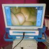 LABORIE COGENTIX Video Cystoscopy  w/ 2 Cameras & Cystoscope PrimeSight Unity UVP-9000 Video Cystoscopy +CST-5000 Cystoscope
