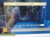 PHILIPS M8007A Intellivue MP70 ,W/ 03 PARAMETERS MMS Module & Leads~, Monitor