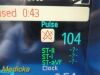 PHILIPS M8007A Intellivue MP70 ,W/ 03 PARAMETERS MMS Module & Leads~, Monitor