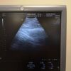GE VOLUSON E8 Ultrasound VOLUSON E8