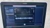PHILIPS Epiq 7G Elite with 4 transducers cardiac Ultrasound - Cardiac - Vascular