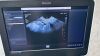 PHILIPS Epiq 7G Elite with 4 transducers cardiac Ultrasound - Cardiac - Vascular