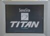 SONOSITE Titan High-Resolution Ultrasound System P04240-11 W/ Transducer C60/5-2 MHz - 170573 Imaging System