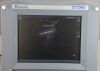 SONOSITE Titan High-Resolution Ultrasound System P04240-11 W/ Transducer C60/5-2 MHz - 170573 Imaging System