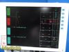 PACE TECH Inc Vitalmax 4000 Vitals Monitor