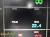 PACE TECH Inc Vitalmax 4000 Vitals Monitor