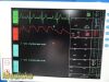 PACE TECH Inc Vitalmax 4000 Vitals Monitor