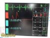 PACE TECH Inc Vitalmax 4000 Vitals Monitor