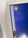 LUMENIS UltraPulse Encore-OR Aesthetic & Surgical Laser System