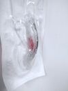 TELEFLEX ALAA010SU LMA Unique Laryngeal Mask Airway , Size 1 In Date 2024/05/28 - 2024/08/28