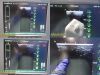 BARD Chison Med SiteRite VI 9770066 Sherlock 3CG Vascular Access Sys W/ Probe