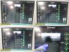 BARD Chison Med SiteRite VI 9770066 Sherlock 3CG Vascular Access Sys W/ Probe