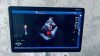 GE Logiq R.6 XDclear with CW Doppler option General Ultrasound