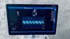 GE Logiq R.6 XDclear with CW Doppler option General Ultrasound