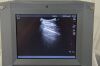 SONOSITE Titan High-Resolution Ultrasound System W/ Transducer C60/5-2 MHz and ICT/8-5 - 170723 Imaging System