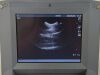 SONOSITE Titan High-Resolution Ultrasound System W/ Transducer C60/5-2 MHz and ICT/8-5 - 170723 Imaging System