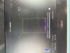 PHILIPS Sparq Ultrasound System