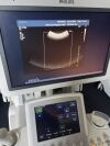 PHILIPS iU22 Ultrasound Machine p/n: 8500-0064 refurbished by  in February 2011 Ultrasound - Shared Service