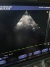 SIEMENS ACUSON X300 Premium Edition U.S Model: 10566144 MFD: 2012 & Probe P8-4 Ultrasound - Shared Service