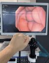 OLYMPUS GIF-HQ190 Gastroscope