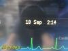 PHILIPS M8007A Intellivue MP70 Neonatal Monitor