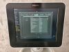 PHILIPS Sparq 2018 General Ultrasound