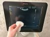 PHILIPS Sparq 2018 General Ultrasound