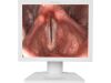 BEACON E190 Monitor
