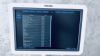 PHILIPS IU22 cart G.1 w/ CW doppler 4 probes EV MSK Ritch Package Ultrasound