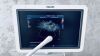 PHILIPS IU22 cart G.1 w/ CW doppler 4 probes EV MSK Ritch Package Ultrasound