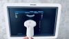 PHILIPS IU22 cart G.1 w/ CW doppler 4 probes EV MSK Ritch Package Ultrasound