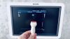 PHILIPS IU22 cart G.1 w/ CW doppler 4 probes EV MSK Ritch Package Ultrasound